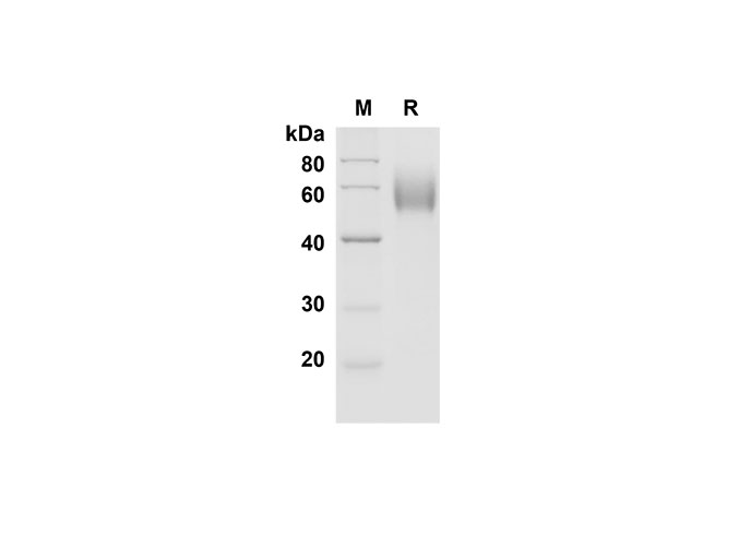 Recombinant Human TGFβ1 Protein-产品推荐-1