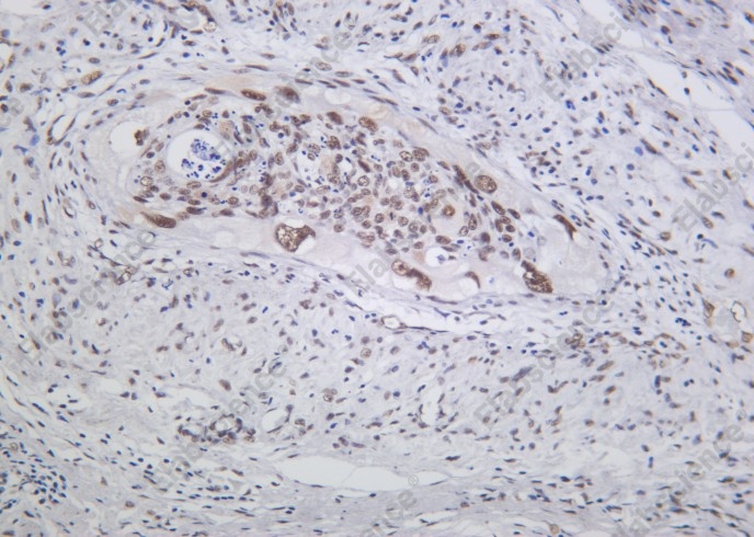 Recombinant MRE11 Monoclonal Antibody - 1
