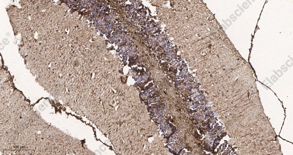 Recombinant GFAP Monoclonal Antibody - 3
