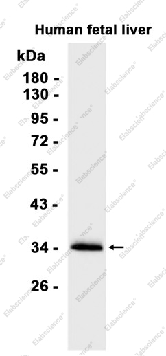 Recombinant SULT2A1/ST2 Monoclonal Antibody - 1
