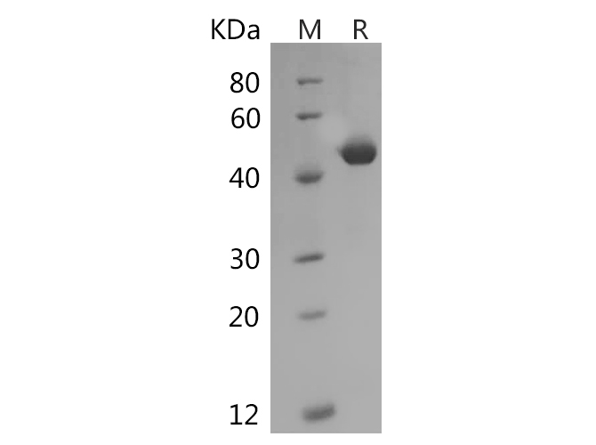 Recombinant Rat IL-1b Protein(Trx Tag)-产品推荐-1
