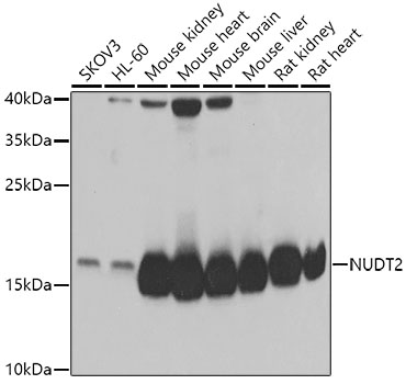 Western blot analysis of extracts of various cell lines using NUDT2 Polyclonal Antibody at 1:1000 dilution.