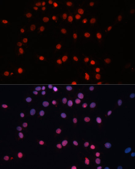 Immunofluorescence analysis of C6 cells using SUMO1 Polyclonal Antibody at dilution of 1:100. Blue: DAPI for nuclear staining.