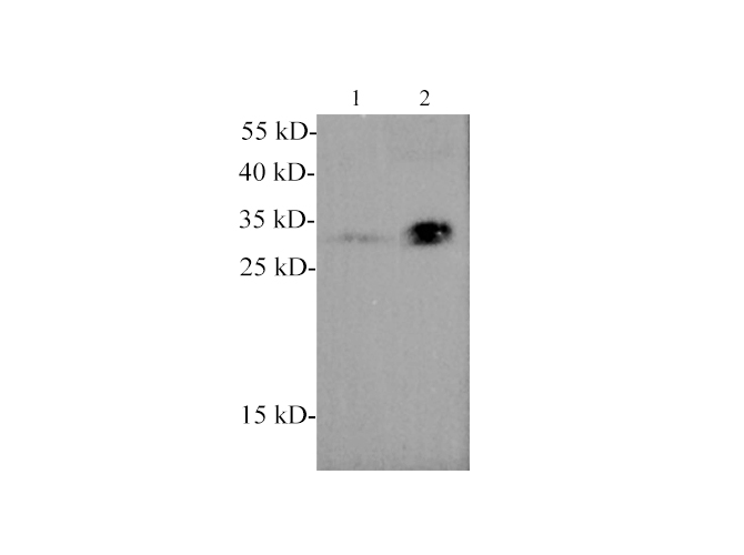 Western blotting with anti-Adiponectin polyclonal antibody at dilution of 1:1000. Lane 1: Mouse plasma, Lane 2: Human plasma.