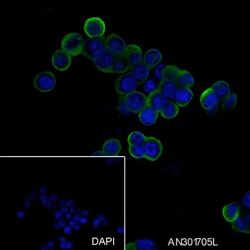 Recombinant DOPA Decarboxylase/DDC Monoclonal Antibody - small - 3