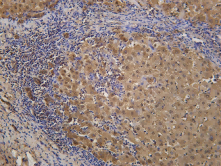 Recombinant OSM Monoclonal Antibody - 1