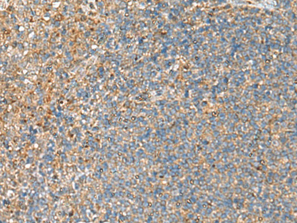 Immunohistochemistry of paraffin-embedded Human tonsil tissue  using NQO2 Polyclonal Antibody at dilution of 1:70(?200)