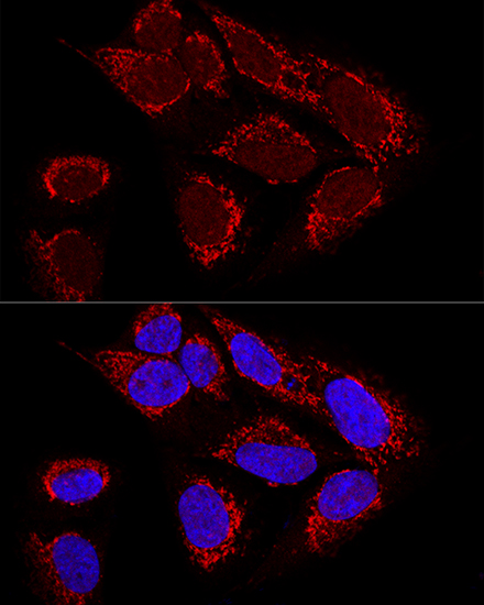 Confocal immunofluorescence analysis of U2OS cells using MTX2 Polyclonal Antibody at dilution of 1:100. Blue: DAPI for nuclear staining.