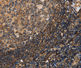 PON1 Polyclonal Antibody - 2