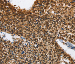 ELAVL1 Polyclonal Antibody - 2