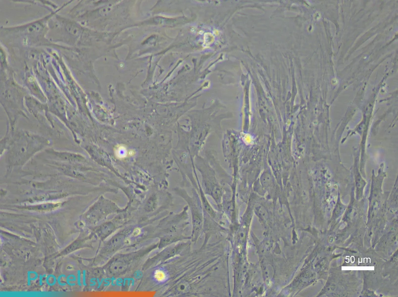 Mouse Mammary Fibroblast Complete Medium - 5