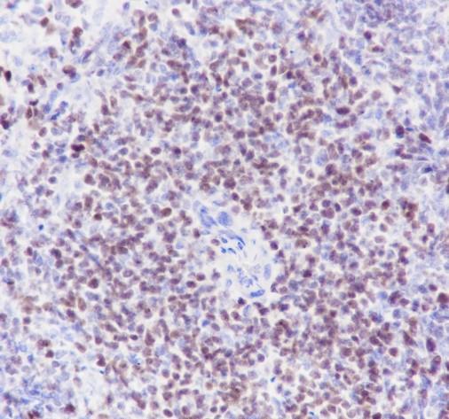 Recombinant SATB1 Monoclonal Antibody - 3