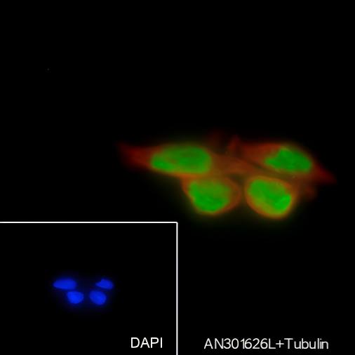 Recombinant PGAM1 Monoclonal Antibody - 3