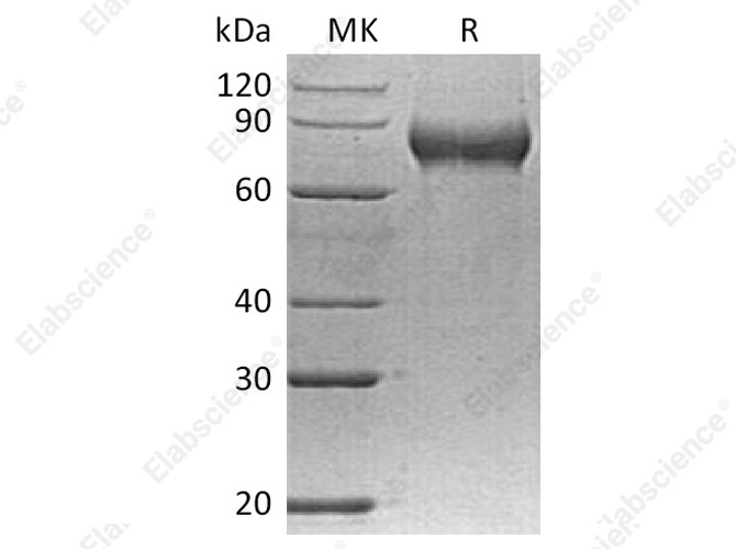 Recombinant Human FLRT2 Protein (His Tag) - 1