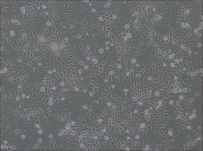 NP69SV40T Cell Complete MediumNP69SV40T Cell Complete Medium - 2