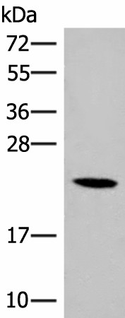 Western blot analysis of 293T cell lysate  using DHFR Polyclonal Antibody at dilution of 1:400