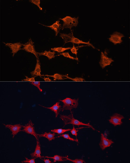 Immunofluorescence analysis of C6 cells using GSTM3 Polyclonal Antibody at dilution of  1:100. Blue: DAPI for nuclear staining.