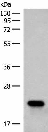 Western blot analysis of Human fetal brain tissue lysate  using RAC3 Polyclonal Antibody at dilution of 1:400