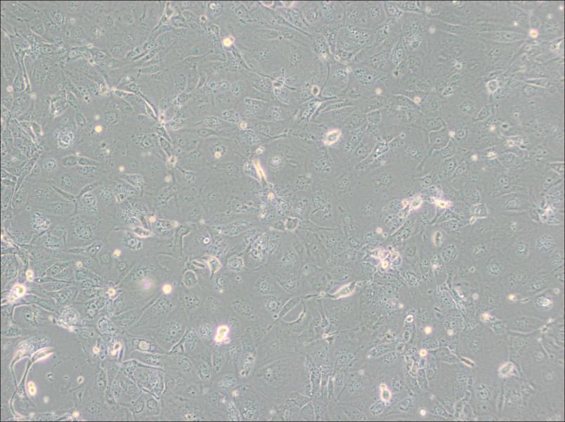 NCI-H2347 Cell Complete Medium - 3