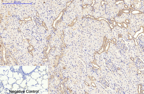 Immunohistochemistry of paraffin-embedded Rat lung tissue using CD20 Monoclonal Antibody at dilution of 1:200.