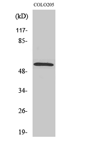 Western Blot analysis of COLO205 cells with Smad2 Polyclonal Antibody.