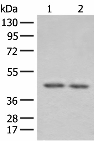 Western blot analysis of 293T cell lysates  using ILKAP Polyclonal Antibody at dilution of 1:800