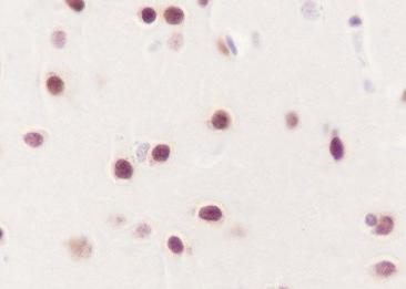 Recombinant AKT1+AKT2+AKT3 Monoclonal Antibody-searchlist-2