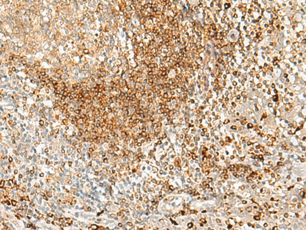 Immunohistochemistry of paraffin-embedded Human tonsil tissue  using HLA-DPA1 Polyclonal Antibody at dilution of 1:35(?200)