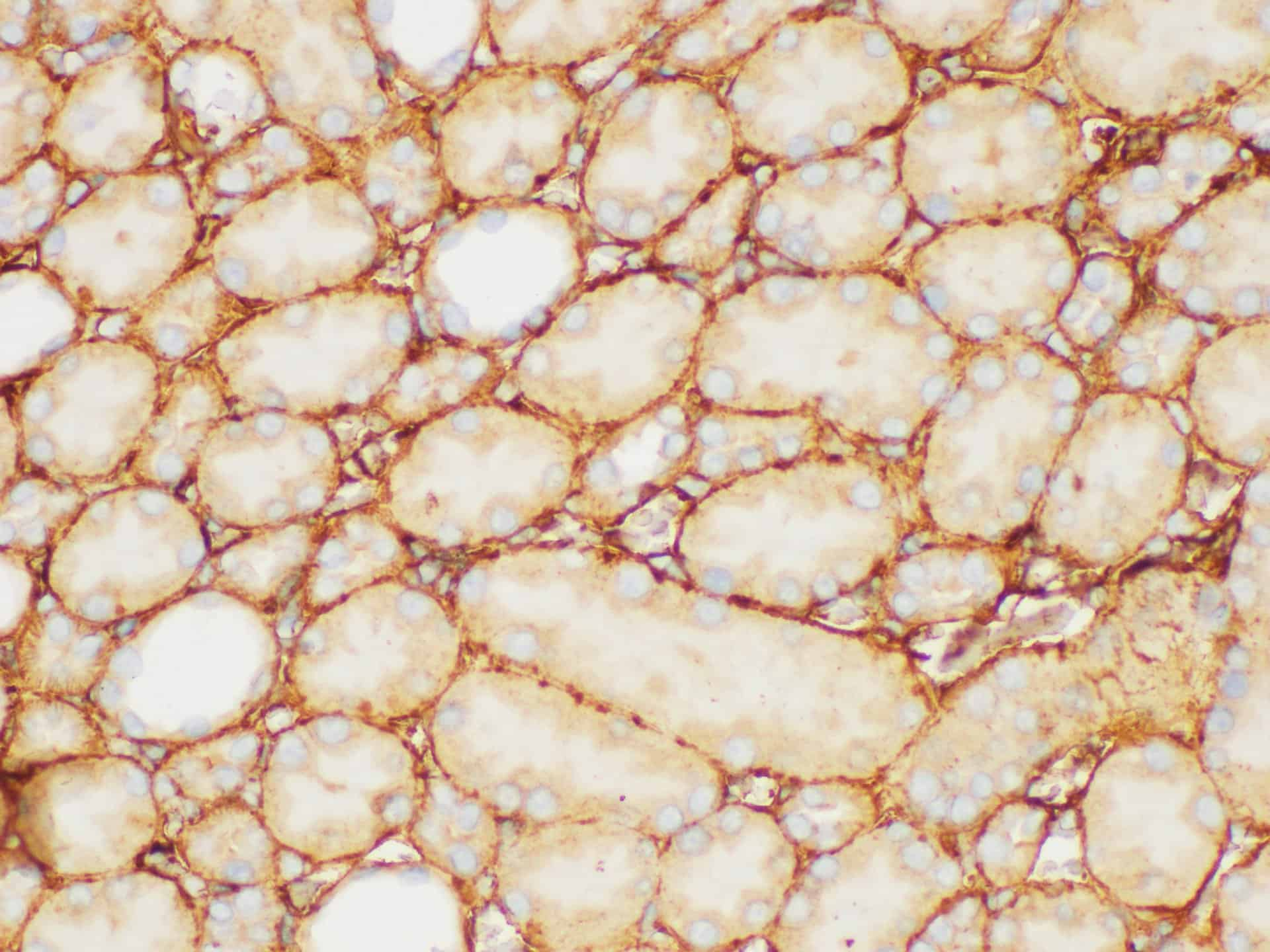 Immunohistochemistry of paraffin-embedded Rat kidney using FGB Polycloanl Antibody at dilution of 1:200