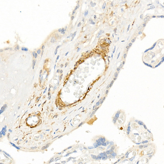Immunohistochemistry of paraffin-embedded human placenta using Transgelin (TAGLN) Polyclonal antibody at dilution of 1:25 (40x lens).Perform high pressure antigen retrieval with 10 mM citrate buffer pH 6.0 before commencing with IHC staining protocol.