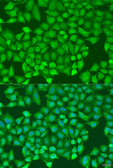 Immunofluorescence analysis of U2OS cells using CTCF Polyclonal Antibody at dilution of 1:100. Blue: DAPI for nuclear staining.