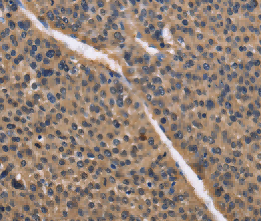 IDH1 Polyclonal Antibody - 2