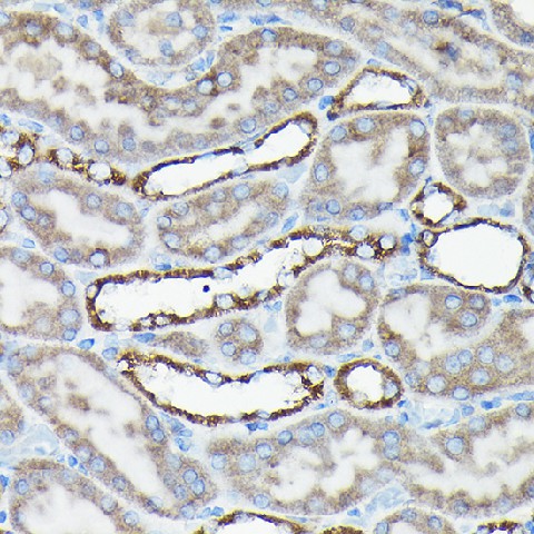 Immunohistochemistry of paraffin-embedded rat kidney using [KO Validated] AIF Polyclonal Antibody at dilution of 1:50 (40x lens).Perform high pressure antigen retrieval with 10 mM citrate buffer pH 6.0 before commencing with IHC staining protocol.