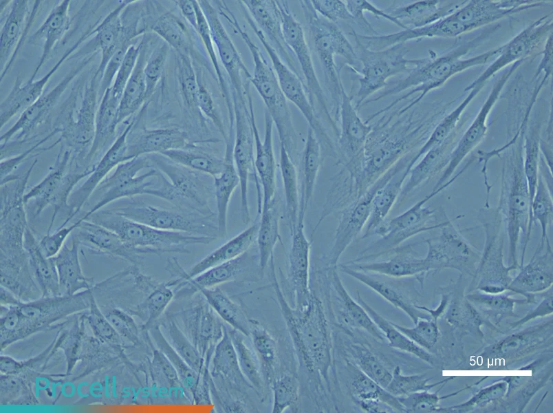 Human Pulmonary Artery Smooth Muscle Cell Complete Medium - small - 4