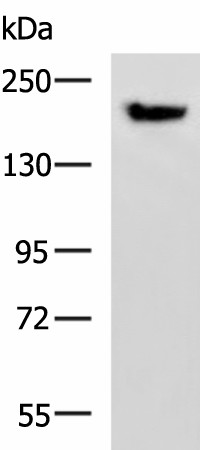 Western blot analysis of Mouse brain tissue lysate  using PDS5B Polyclonal Antibody at dilution of 1:800