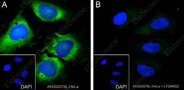 Recombinant Phospho-S6 Ribosomal Protein (Ser240, 244) Monoclonal Antibody - 7