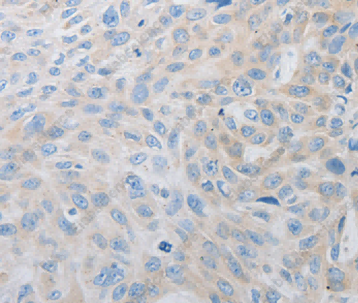 PDX1 Polyclonal Antibody - 3