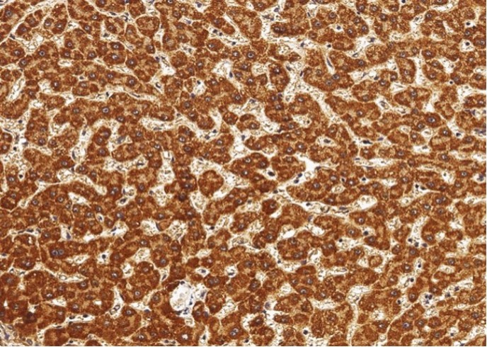 ALDH7A1 Monoclonal Antibody - small - 2