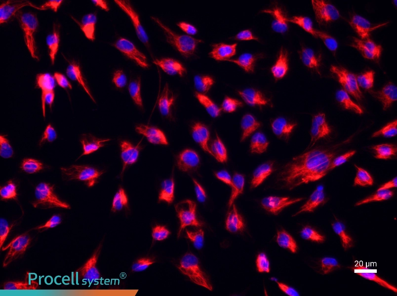Rat Cardiac FibroblastsRat Cardiac Fibroblasts - 2