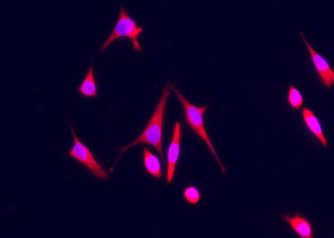 Recombinant S100A7 Monoclonal Antibody-searchlist-1