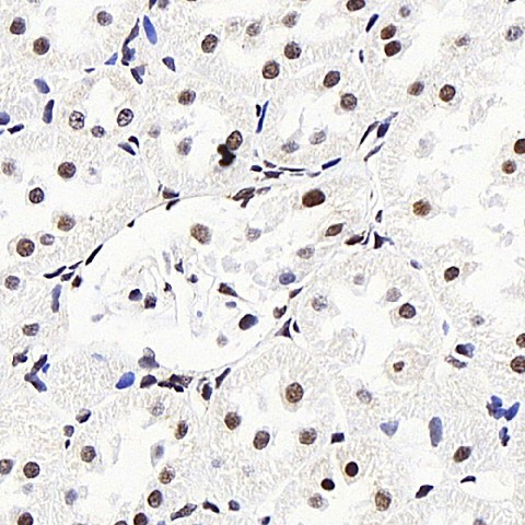 Immunohistochemistry analysis of paraffin-embedded rat kidney  using LXR alpha Polyclonal Antibody at dilution of 1:400.