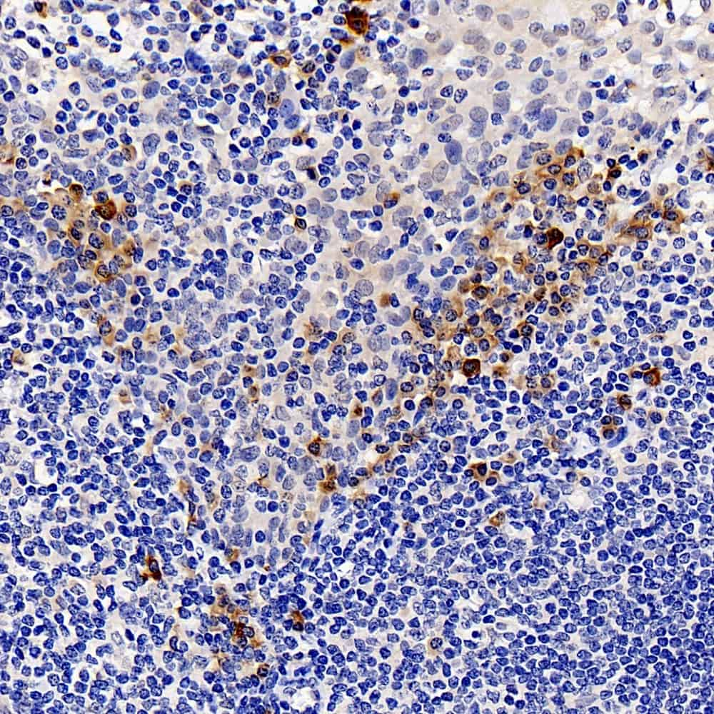 Immunohistochemistry analysis of paraffin-embedded human tonsil  using CASP1 Polyclonal Antibody at dilution of 1:300.