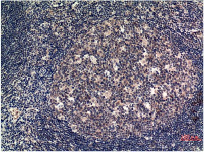 Immunohistochemistry of paraffin-embedded Human tonsil tissue using MLKL Monoclonal Antibody at dilution of 1:200.