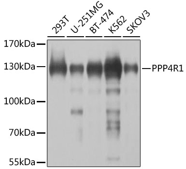 Western blot analysis of extracts of various cell lines using PPP4R1 Polyclonal Antibody at 1:1000 dilution.