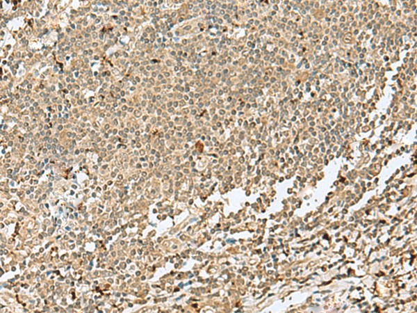 Immunohistochemistry of paraffin-embedded Human tonsil tissue  using SNAPC1 Polyclonal Antibody at dilution of 1:40(?200)