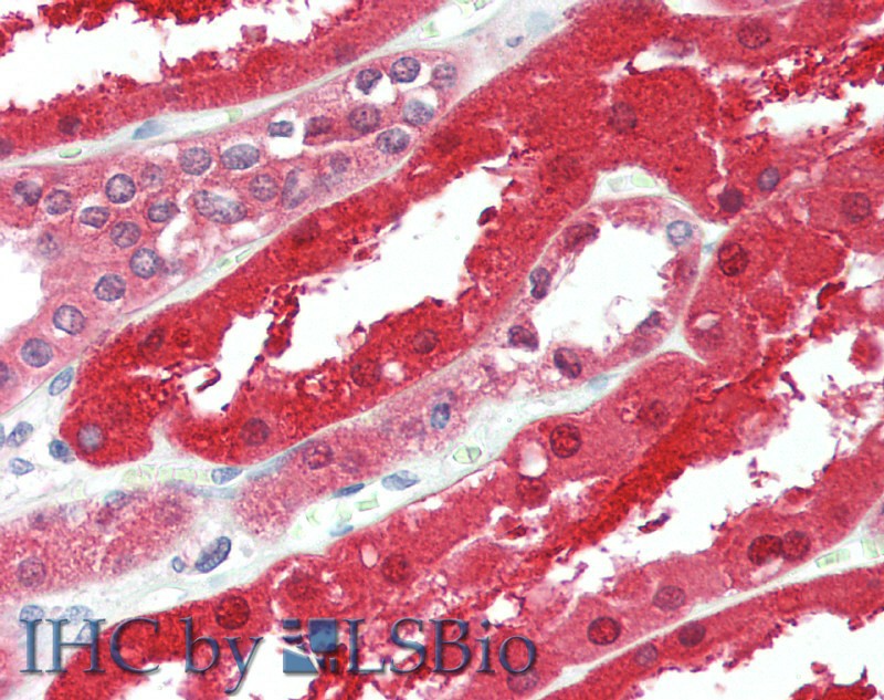 Immunohistochemistry of paraffin-embedded Kidney tissue using GPC6 Polyclonal Antibody at dilution of 1:90(Elabscience Product Detected by Lifespan).