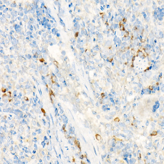 Immunohistochemistry of paraffin-embedded rat spleen using IL27RA Polyclonal antibody at dilution of 1:25 (40x lens).Perform high pressure antigen retrieval with 10 mM citrate buffer pH 6.0 before commencing with IHC staining protocol.