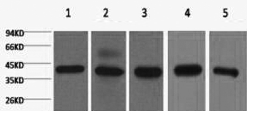 Western Blot analysis of 1) 293T, 2) Hela, 3) HepG2, 4) Mouse brain with eIF4A1 Monoclonal Antibody.