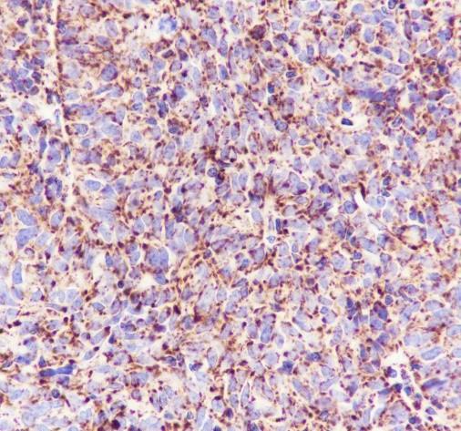 Recombinant UQCRFS1/RISP Monoclonal Antibody - 3