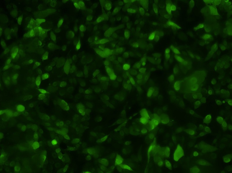 PC-3-GFP Cell Complete Medium - 2